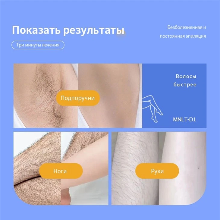 Машина для удаления волос красоты Алмы